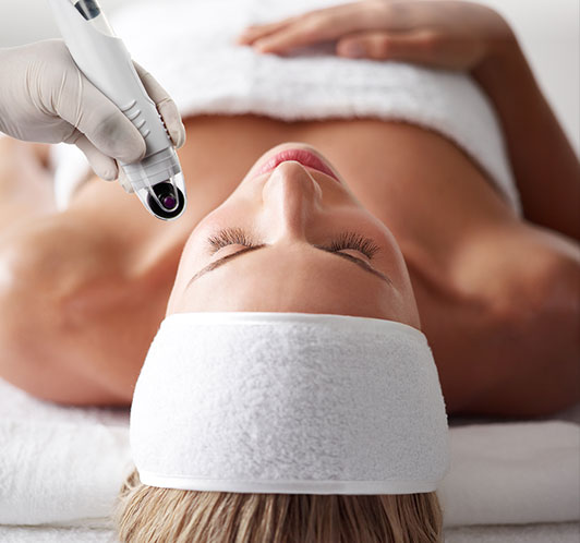 Microneedling Dermafrac
