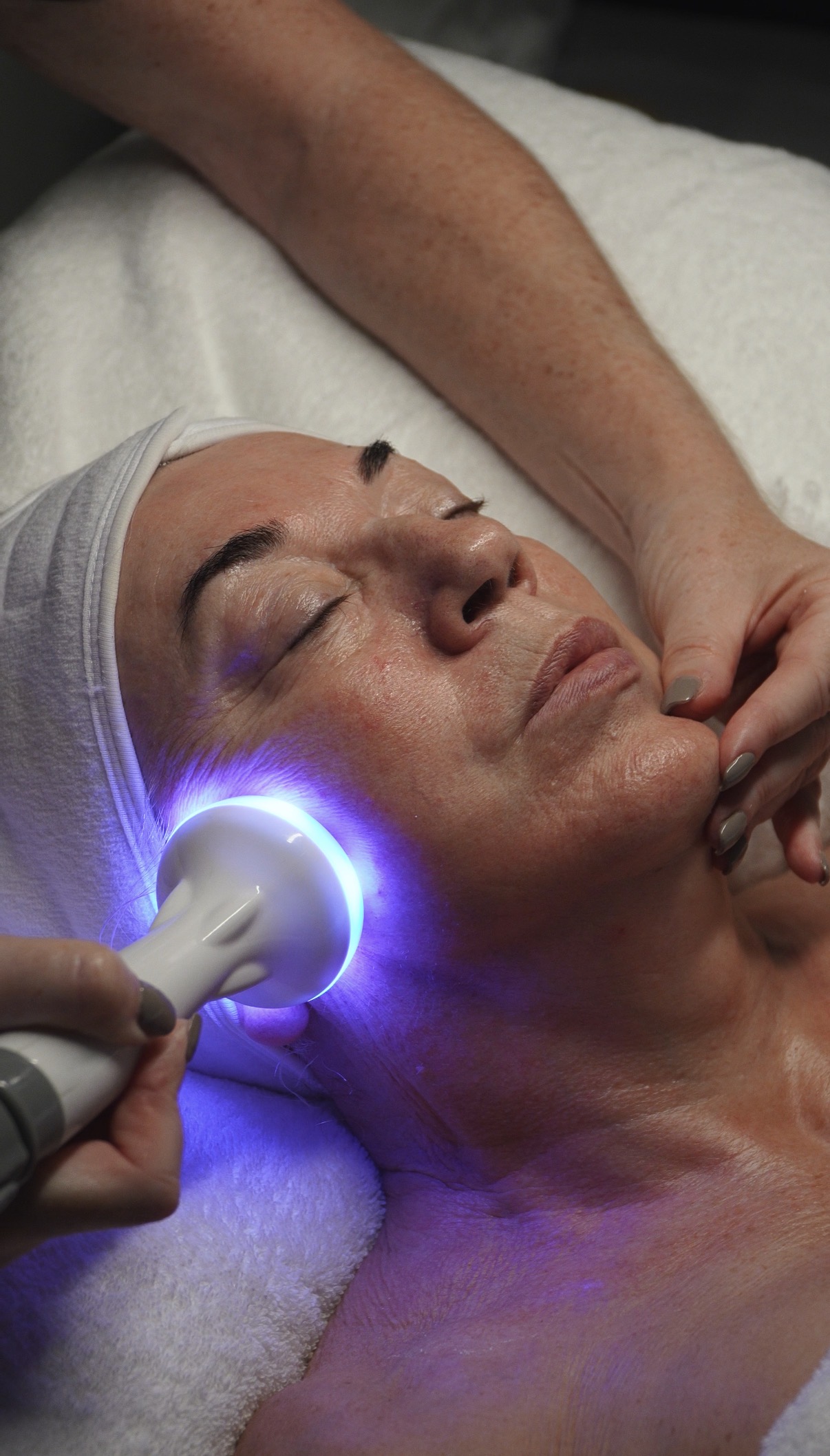 Radio Frequency Dermatherm
